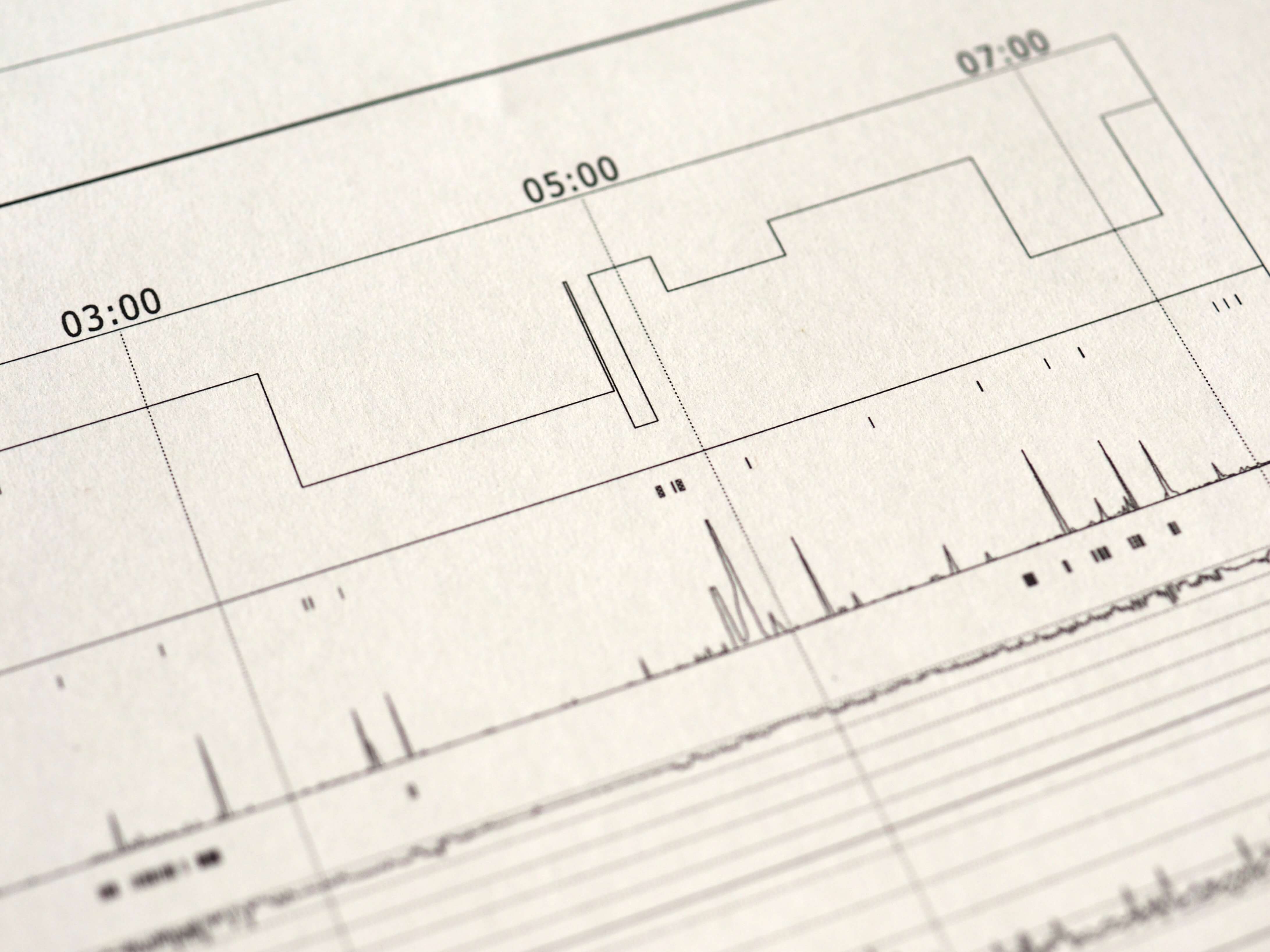 Polysomnographie